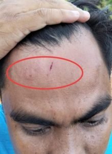 Colektor (Kabiro Sinarglobalnusantara) Mengalami Kekerasan Dari Oknum Wartawan