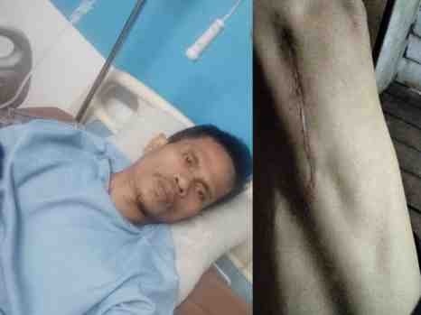 Hak Tak Kunjung Diberikan, Korban Kecelakaan Kerja Desak Wasnaker Riau Segera Tangani Laporan